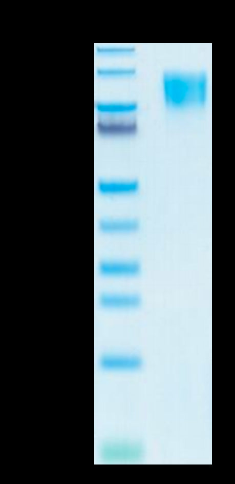 Human PDGF R beta on Tris-Bis PAGE under reduced conditions. The purity is greater than 95%.Recombinant Human PDGF R beta/CD140b Protein, Active