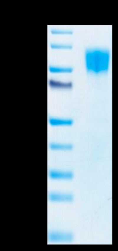 Biotinylated Human PDGF R beta on Tris-Bis PAGE under reduced conditions. The purity is greater than 95%.Biotinylated Human PDGF R beta/CD140b Protein, Active