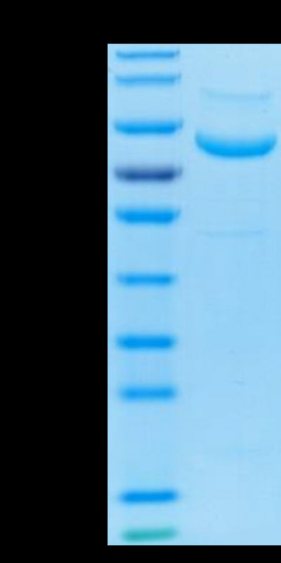 Biotinylated Human LRRC15 on Tris-Bis PAGE under reduced condition. The purity is greater than 95%.Biotinylated Human LRRC15/LIB Protein, Active