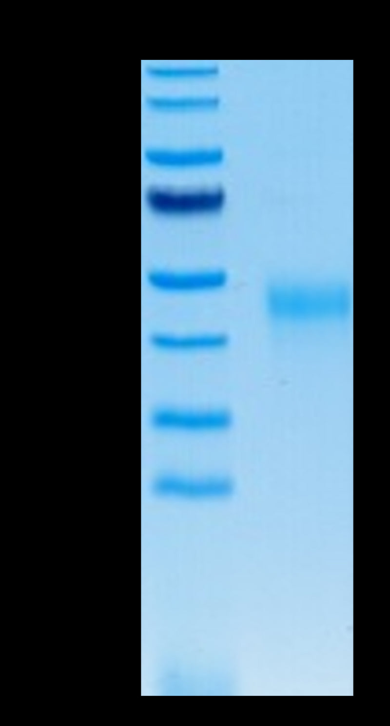 Human KIR2DL2 on Tris-Bis PAGE under reduced conditions. The purity is greater than 95%.Recombinant Human KIR2DL2 Protein