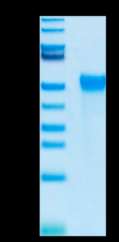 Biotinylated Human KIR2DL2 on Tris-Bis PAGE under reduced conditions. The purity is greater than 95%.Biotinylated Human KIR2DL2 Protein