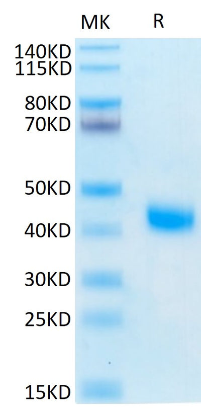 Human IL-2 R beta on Tris-Bis PAGE under reduced condition. The purity is greater than 95%.Recombinant Human IL-2 R beta/CD122 Protein, Active