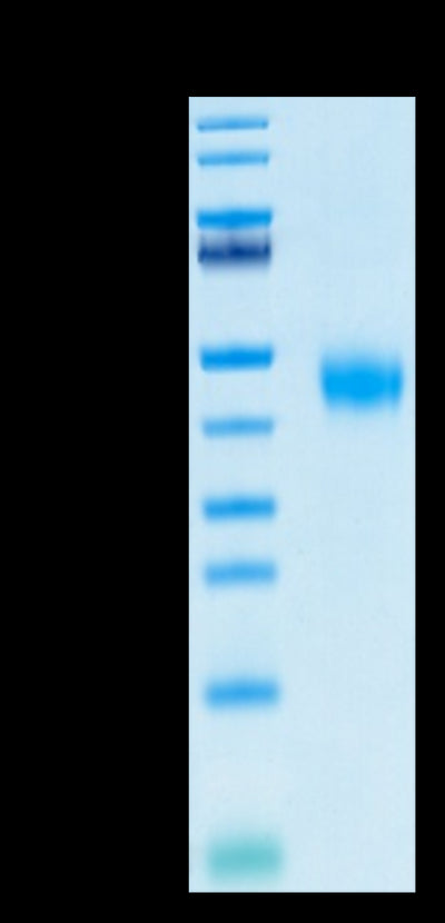 Biotinylated Human IL-2 R beta on Tris-Bis PAGE under reduced condition. The purity is greater than 95%.Biotinylated Human IL-2 R beta/CD122 Protein, Active