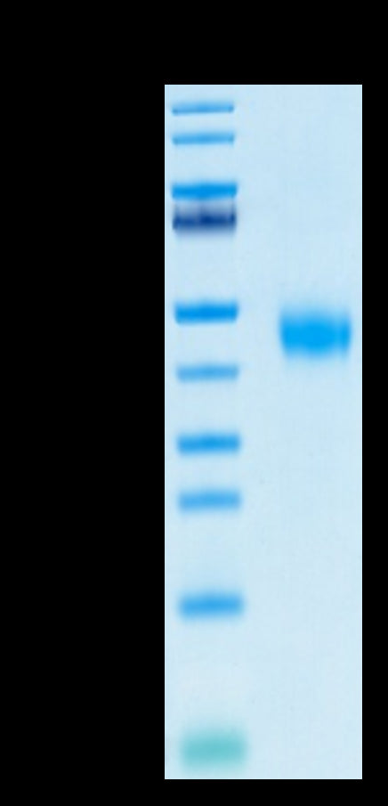 Biotinylated Human IL-2 R beta on Tris-Bis PAGE under reduced condition. The purity is greater than 95%.Biotinylated Human IL-2 R beta/CD122 Protein, Active