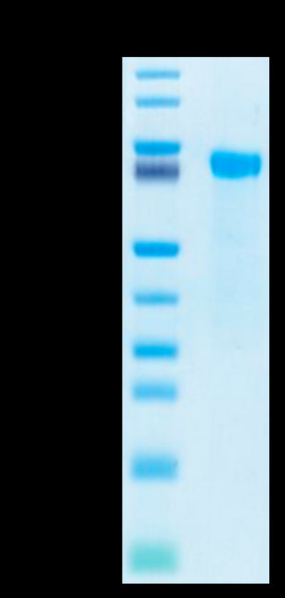 Biotinylated Human Notch 2 on Tris-Bis PAGE under reduced conditions. The purity is greater than 95%.Biotinylated Human Notch 2 Protein