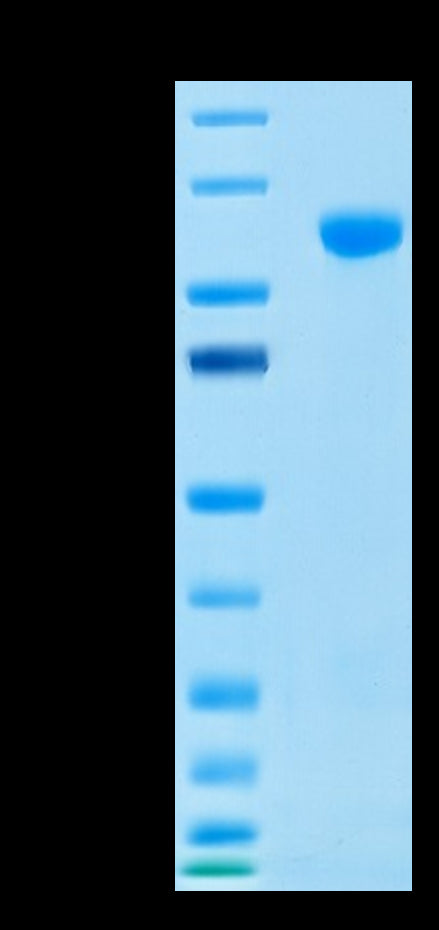 Human MMP-9 on Tris-Bis PAGE under reduced condition. The purity is greater than 95%.Recombinant Human MMP-9 Protein, Active