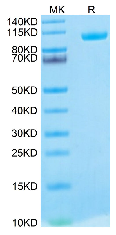 Biotinylated Human MMP-9 on Tris-Bis PAGE under reduced condition. The purity is greater than 95%.Biotinylated Human MMP-9 Protein, Active