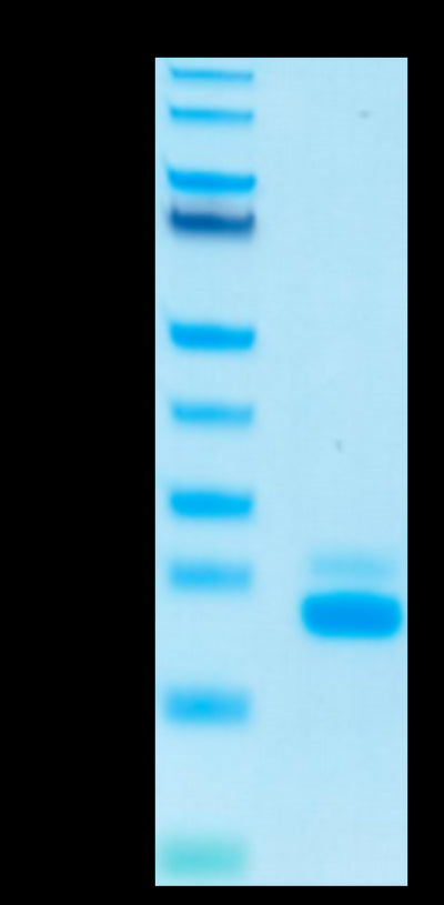 Human TRAIL R2 on Tris-Bis PAGE under reduced condition. The purity is greater than 95%.Recombinant Human TRAIL R2/DR5/TNFRSF10B Protein, Active