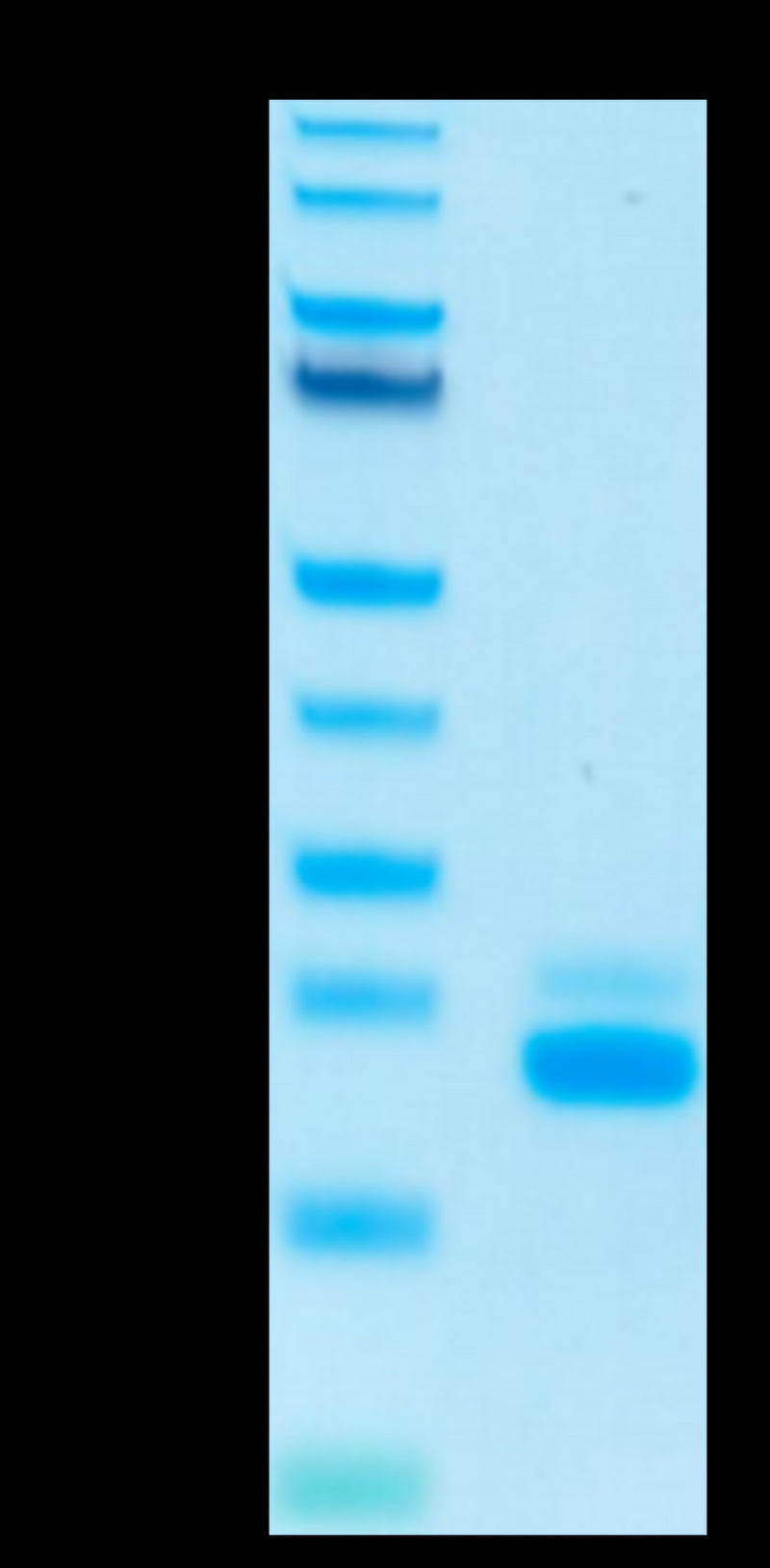 Human TRAIL R2 on Tris-Bis PAGE under reduced condition. The purity is greater than 95%.Recombinant Human TRAIL R2/DR5/TNFRSF10B Protein, Active