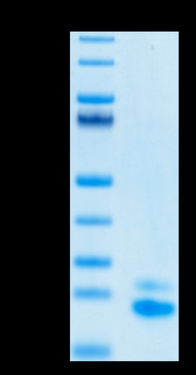 Biotinylated Human TRAIL R2 on Tris-Bis PAGE under reduced conditions. The purity is greater than 95%.Biotinylated Human TRAIL R2/DR5/TNFRSF10B Protein, Active