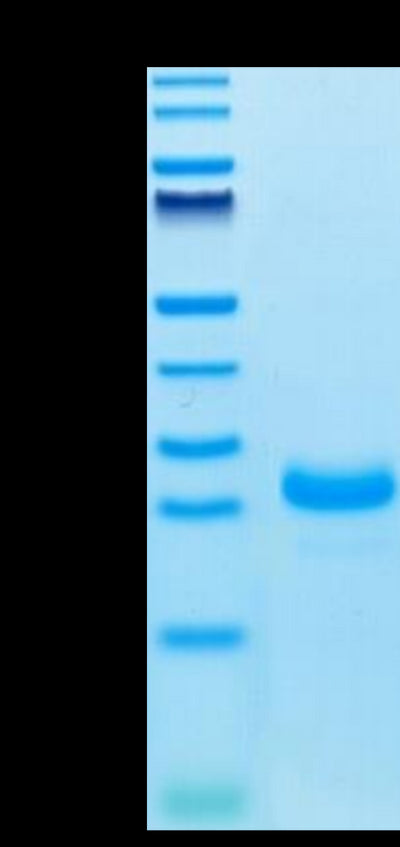 Cynomolgus IL-33 on Tris-Bis PAGE under reduced condition. The purity is greater than 95%.Recombinant Cynomolgus IL-33 Protein, Active