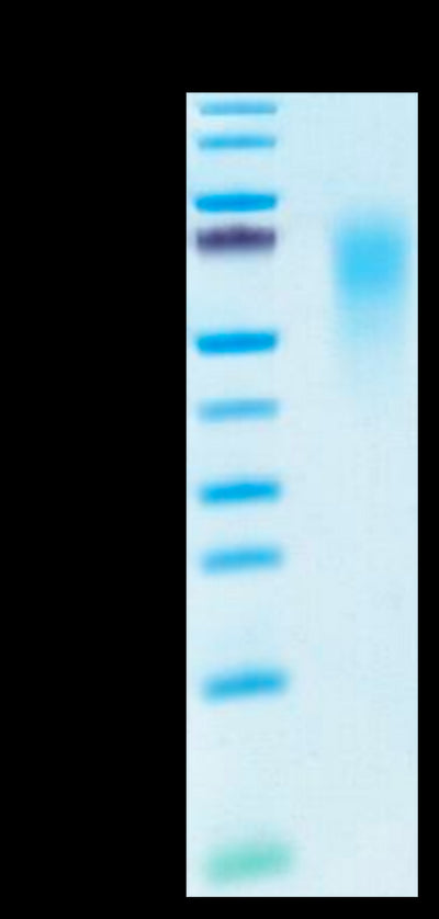 Human CEACAM-6 on Tris-Bis PAGE under reduced condition. The purity is greater than 95%.Recombinant Human CEACAM-6/CD66c Protein, Active