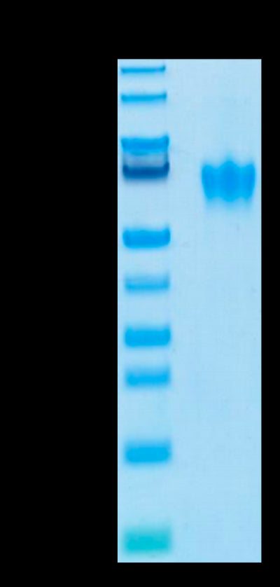 Biotinylated Human CEACAM-6 on Tris-Bis PAGE under reduced condition. The purity is greater than 95%.Biotinylated Human CEACAM-6/CD66c Protein, Active