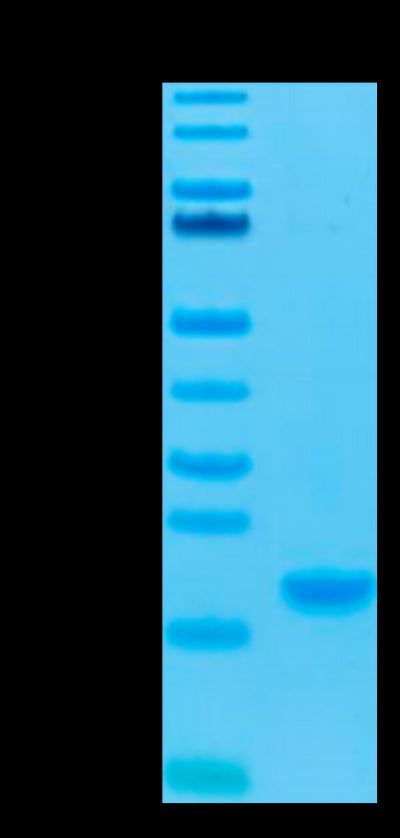 Human IL-7 on Tris-Bis PAGE under reduced condition. The purity is greater than 95%.Recombinant Human IL-7 Protein, Active
