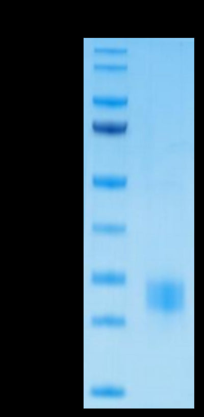 Biotinylated Human CTLA-4 on Tris-Bis PAGE under reduced condition. The purity is greater than 95%.Biotinylated Human CTLA-4/CD152 Protein, Active