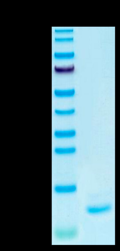 Human IL-15 on Tris-Bis PAGE under reduced condition. The purity is greater than 95%.Recombinant Human IL-15 Protein, Active