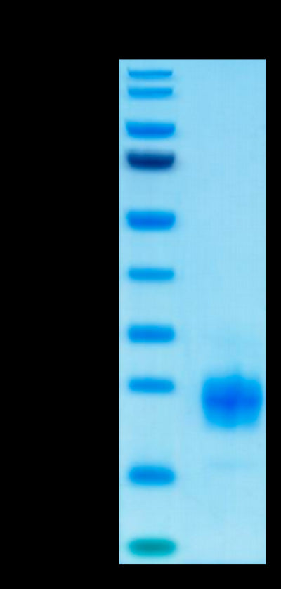 Biotinylated Human TIGIT on Tris-Bis PAGE under reduced condition. The purity is greater than 95%.