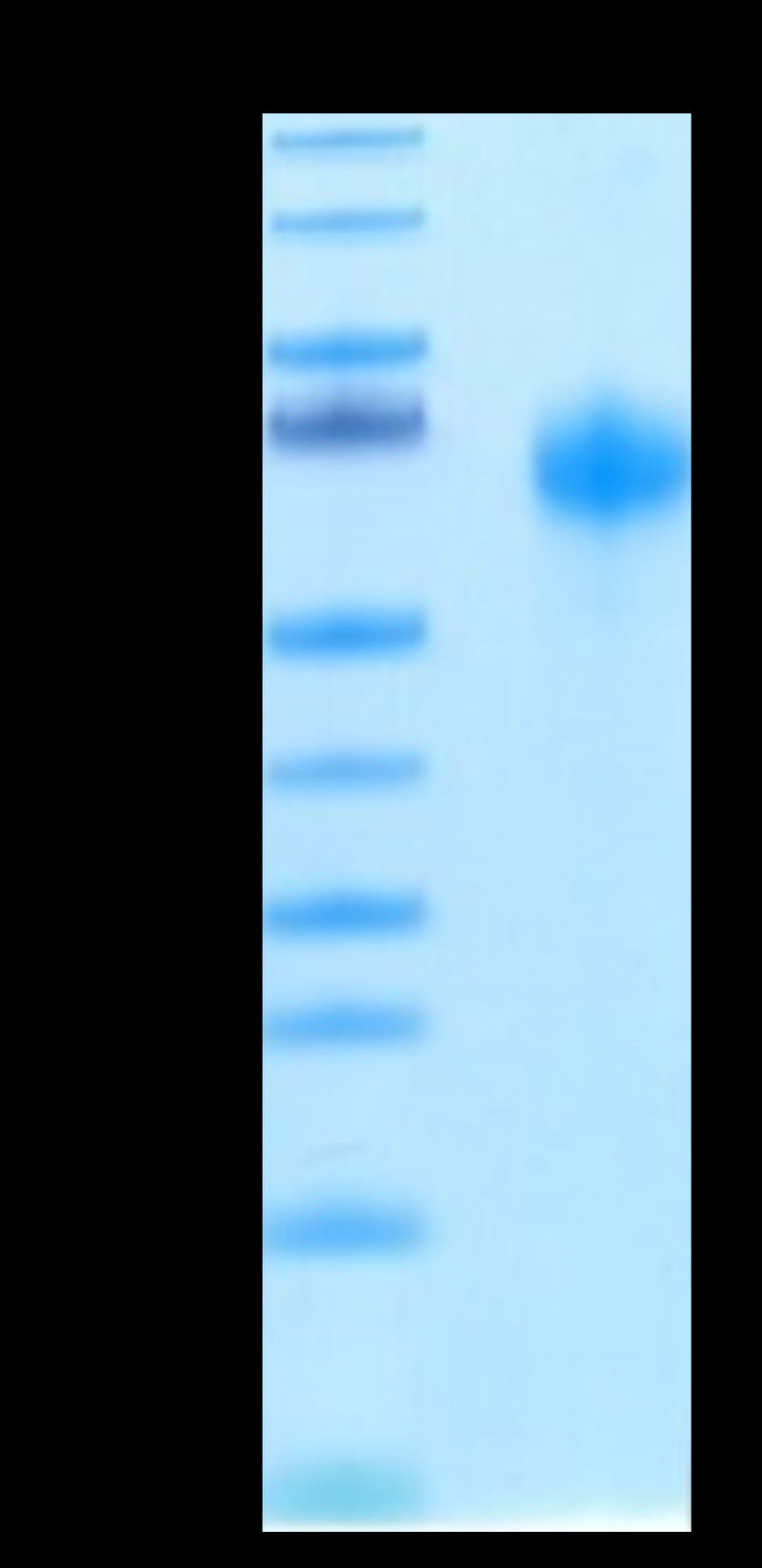 Biotinylated Human IL-1R3 on Tris-Bis PAGE under reduced condition. The purity is greater than 95%.Biotinylated Human IL-1R3/IL-1 RAcP Protein, Active