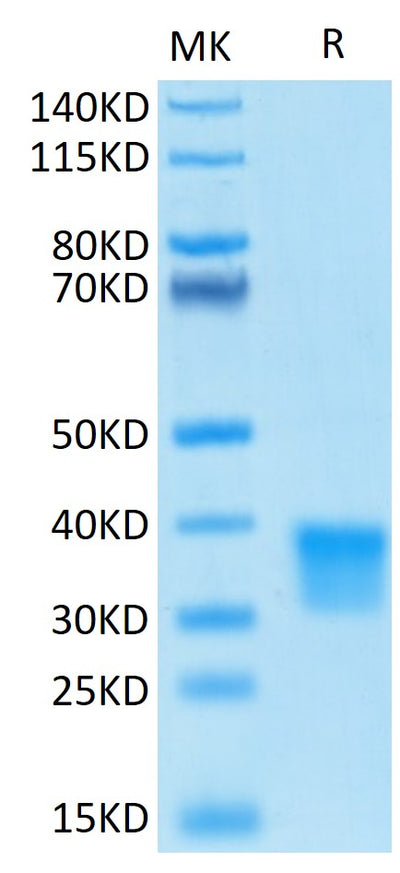 Human OSM on Tris-Bis PAGE under reduced conditions. The purity is greater than 95%.Recombinant Human Oncostatin M/OSM Protein, Active
