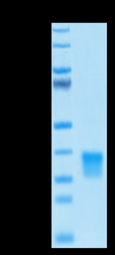 Biotinylated Oncostatin M on Tris-Bis PAGE under reduced conditions. The purity is greater than 95%.Biotinylated Human Oncostatin M/OSM Protein, Active