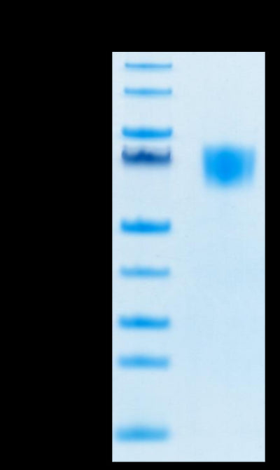 Biotinylated Human FGFR3 alpha- (IIIc) on Tris-Bis PAGE under reduced conditions. The purity is greater than 95%.Biotinylated Human FGFR3 alpha (IIIc) Protein, Active