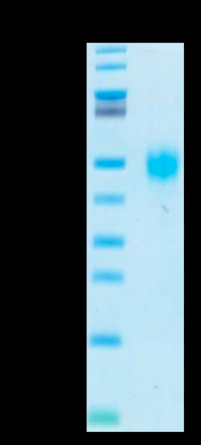 Biotinylated Human KIR2DL3-on Tris-Bis PAGE under reduced conditions. The purity is greater than 95%.Biotinylated Human KIR2DL3 Protein