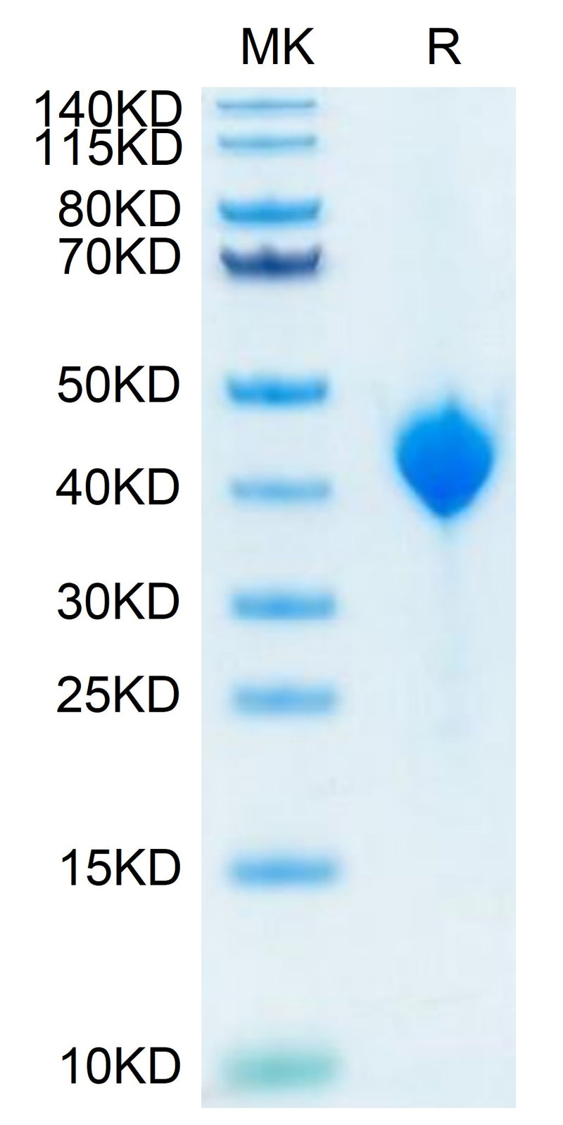 Cynomolgus Nectin-4 on Tris-Bis PAGE under reduced conditions. The purity is greater than 95%.Recombinant Cynomolgus Nectin-4 Protein, Active