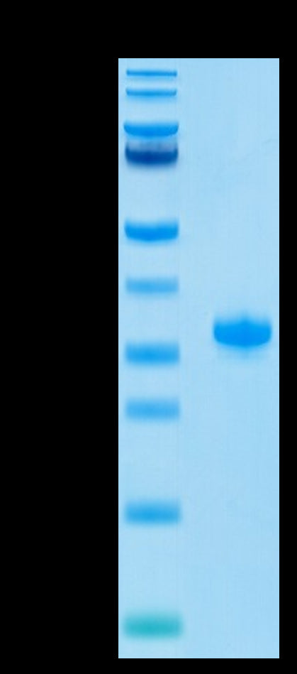 Human IgG4 Fc on Tris-Bis PAGE under reduced condition. The purity is greater than 95%.Recombinant Human IgG4 Fc Protein, Active