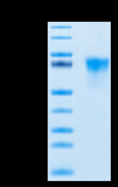 Human FGFR3 alpha (IIIb) on Tris-Bis PAGE under reduced conditions. The purity is greater than 95%.Recombinant Human FGFR3 alpha (IIIb) Protein, Active