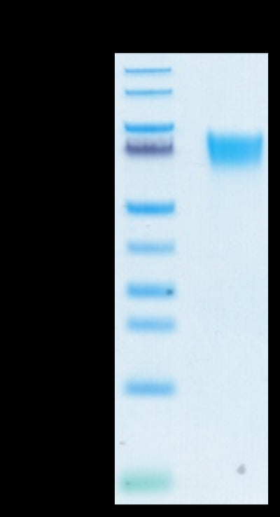 Biotinylated Human FGFR3 alpha (IIIb) on Tris-Bis PAGE under reduced conditions. The purity is greater than 95%.Biotinylated Human FGFR3 alpha (IIIb) Protein, Active