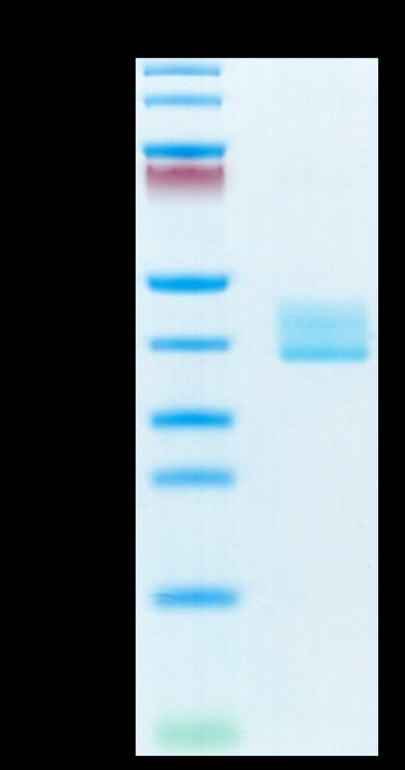 Mouse BCMA on Tris-Bis PAGE under reduced condition. The purity is greater than 95%.Recombinant Mouse BCMA/TNFRSF17 Protein, Active