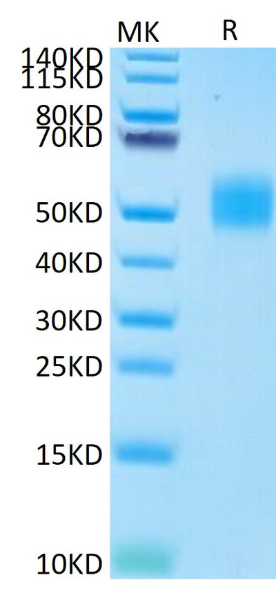 Human MICB on Tris-Bis PAGE under reduced conditions. The purity is greater than 95%.Recombinant Human MICB Protein, Active