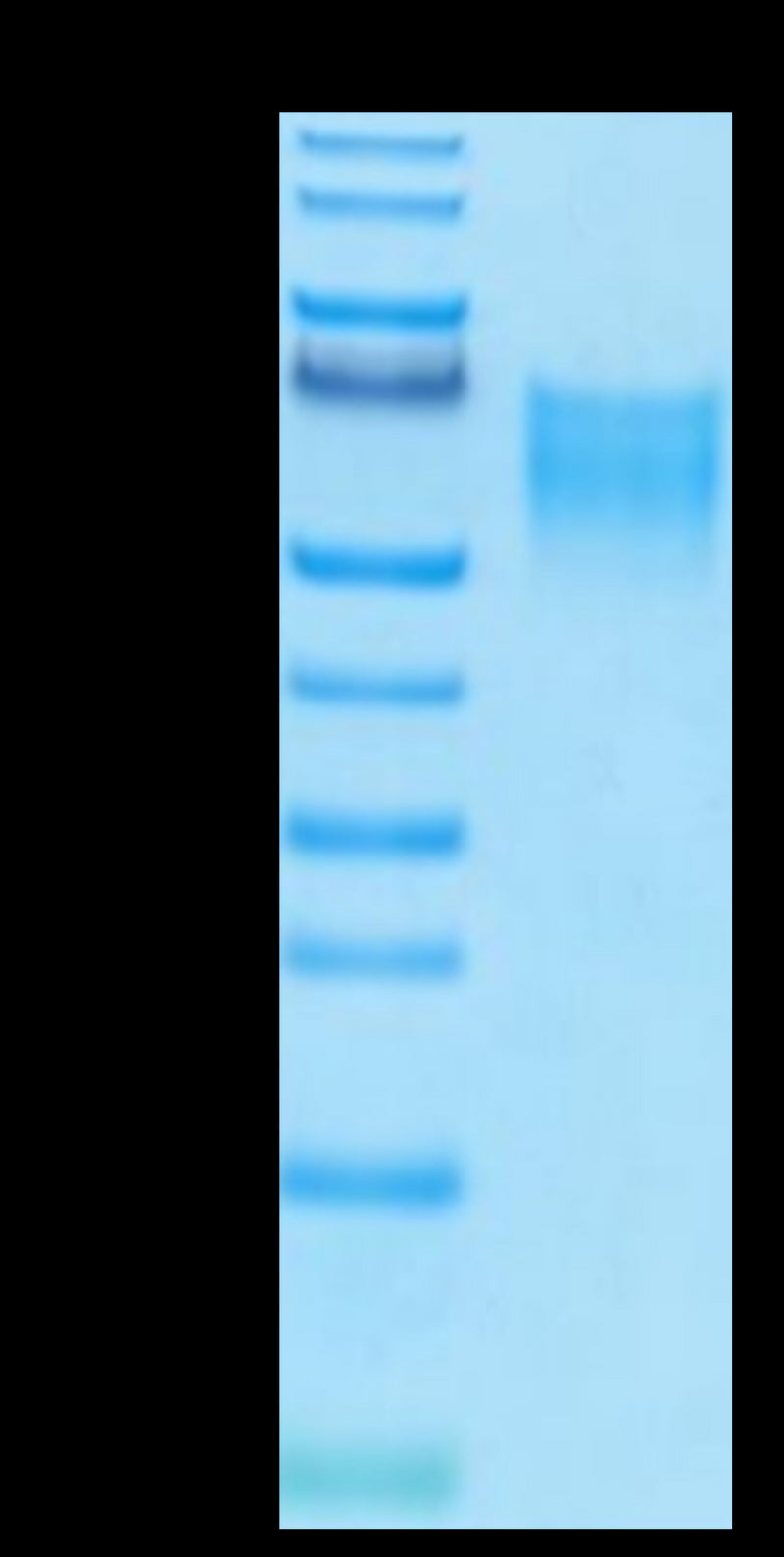 Biotinylated Human B7-2 on Tris-Bis PAGE under reduced condition. The purity is greater than 95%.Biotinylated Human B7-2/CD86 Protein, Active