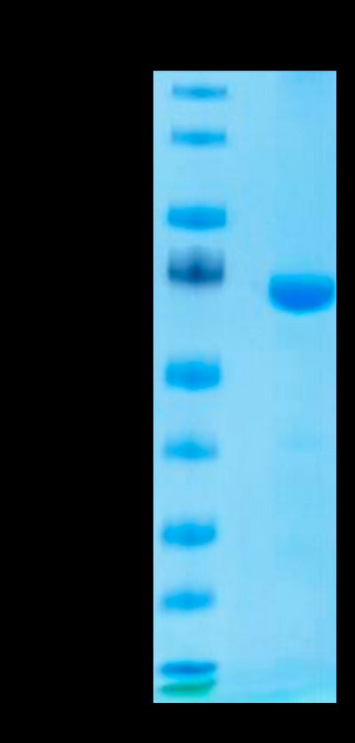 Mouse LAG3 on Tris-Bis PAGE under reduced condition. The purity is greater than 95%.Recombinant Mouse LAG3/CD223 Protein, Active