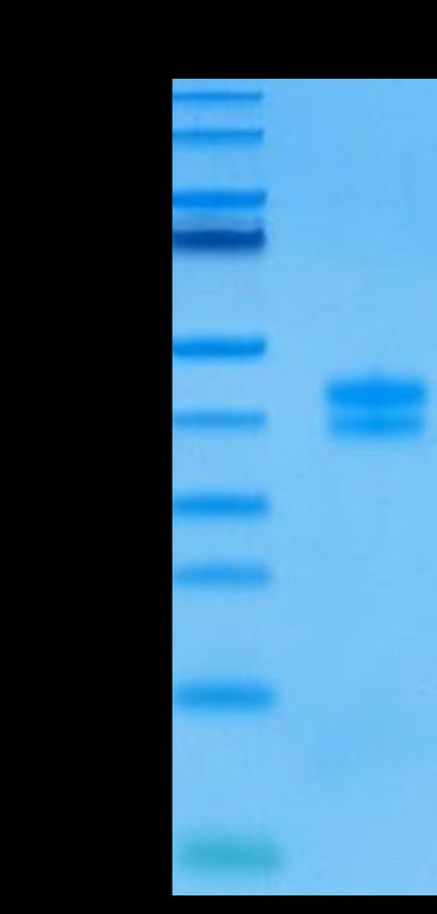 Human GPA33 on Tris-Bis PAGE under reduced condition. The purity is greater than 95%.Recombinant Human GPA33/A33 Protein, Active