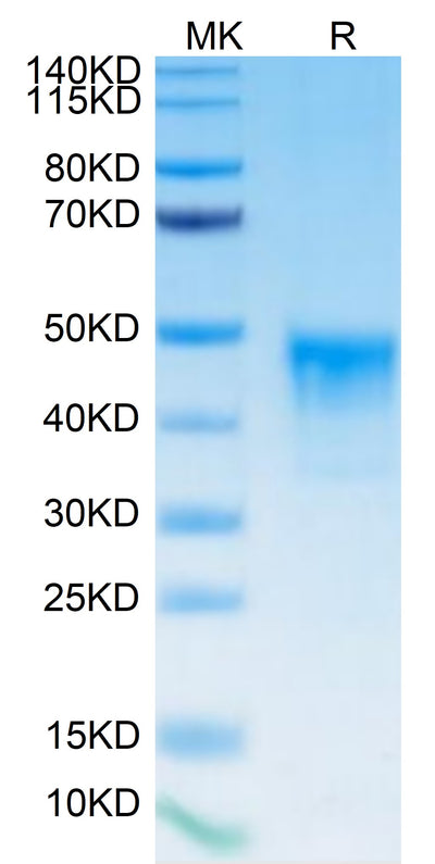 Biotinylated Human MSLN on Tris-Bis PAGE under reduced condition. The purity is greater than 95%.Biotinylated Human MSLN/Mesothelin Protein, Active