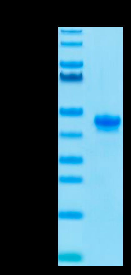 Mouse Nectin-4 on Tris-Bis PAGE under reduced conditions. The purity is greater than 95%.Recombinant Mouse Nectin-4 Protein, Active