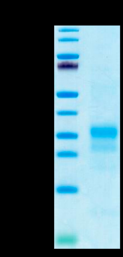 Human IFN gamma on Tris-Bis PAGE under reduced condition. The purity is greater than 95%.Recombinant Human IFN gamma/IFNG Protein, Active