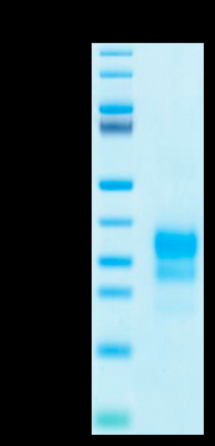 Biotinylated Human IFN gamma on Tris-Bis PAGE under reduced condition. The purity is greater than 95%.Biotinylated Human IFN gamma/IFNG Protein, Active