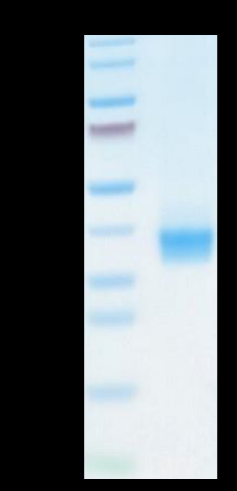 Biotinylated Cynomolgus/Rhesus macaque PD-L1 on Tris-Bis PAGE under reduced conditions. The purity is greater than 95%.Biotinylated Cynomolgus/Rhesus macaque PD-L1/B7-H1 Protein (Primary Amine Labeling), Active