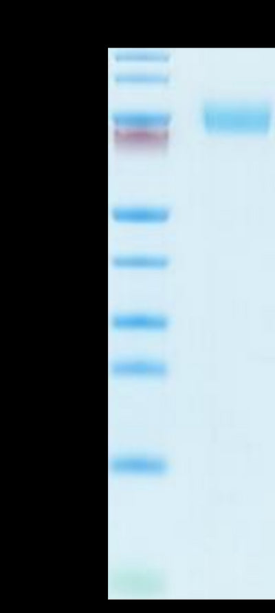 Mouse E-selectin on Tris-Bis PAGE under reduced conditions. The purity is greater than 95%.Recombinant Mouse E-Selectin/CD62E Protein