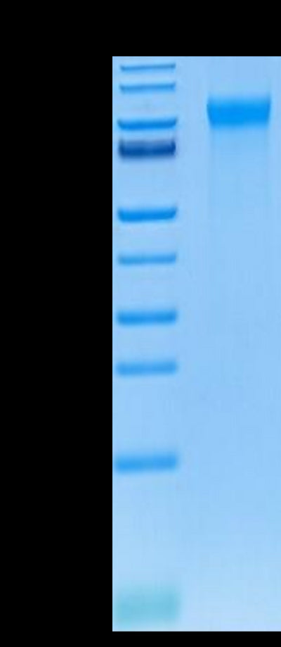 Human E-selectin on Tris-Bis PAGE under reduced condition. The purity is greater than 95%.Recombinant Human E-Selectin/CD62E Protein, Active