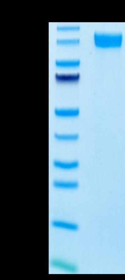 Human E-selectin on Tris-Bis PAGE under reduced conditions. The purity is greater than 95%.Recombinant Human E-Selectin/CD62E Protein, Active