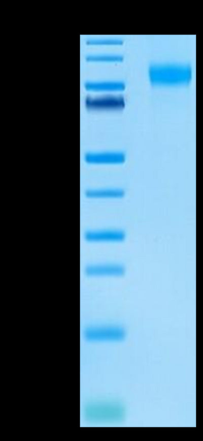 Biotinylated Human E-selectin on Tris-Bis PAGE under reduced condition. The purity is greater than 95%.Biotinylated Human E-Selectin/CD62E Protein, Active