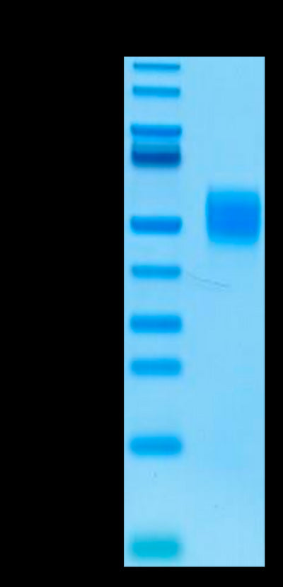 Biotinylated Human MICB on Tris-Bis PAGE under reduced conditions. The purity is greater than 95%.Biotinylated Human MICB Protein, Active