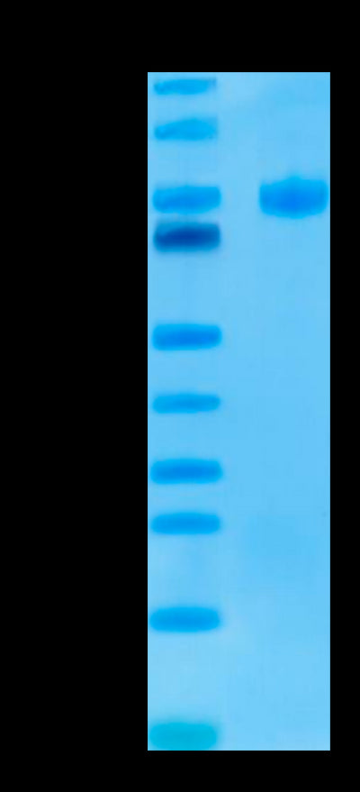 Human Endoglin on Tris-Bis PAGE under reduced conditions. The purity is greater than 95%.Recombinant Human Endoglin/CD105 Protein, Active