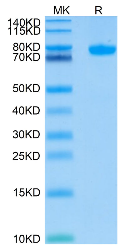 Human Siglec-8 on Tris-Bis PAGE under reduced conditions. The purity is greater than 95%.Recombinant Human Siglec-8 Protein