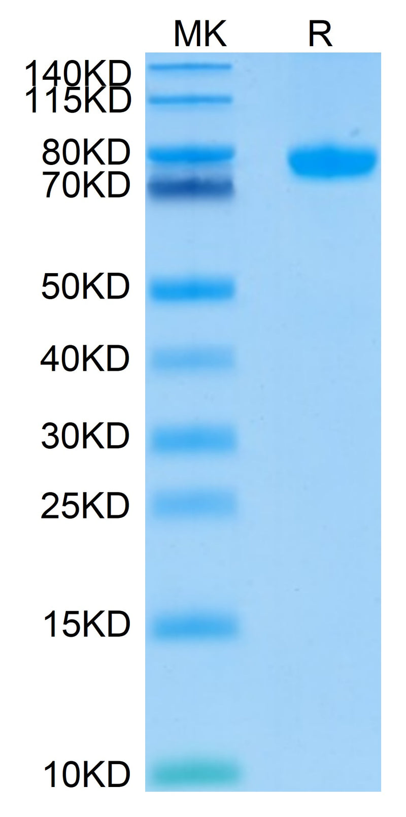 Human Siglec-8 on Tris-Bis PAGE under reduced conditions. The purity is greater than 95%.Recombinant Human Siglec-8 Protein