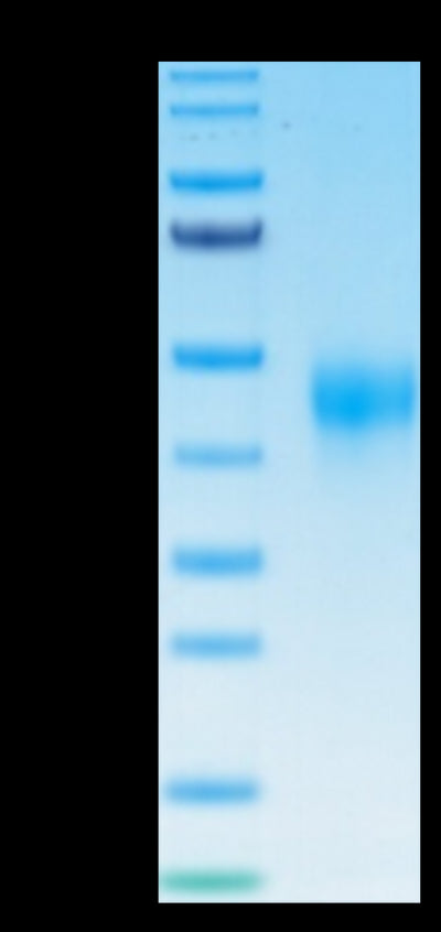 Human TFPI on Tris-Bis PAGE under reduced condition. The purity is greater than 95%.Recombinant Human TFPI Protein
