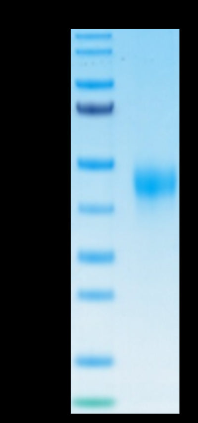 Biotinylated Human TFPI on Tris-Bis PAGE under reduced condition. The purity is greater than 95%.Biotinylated Human TFPI Protein